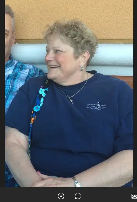 Linda H. before treatment
