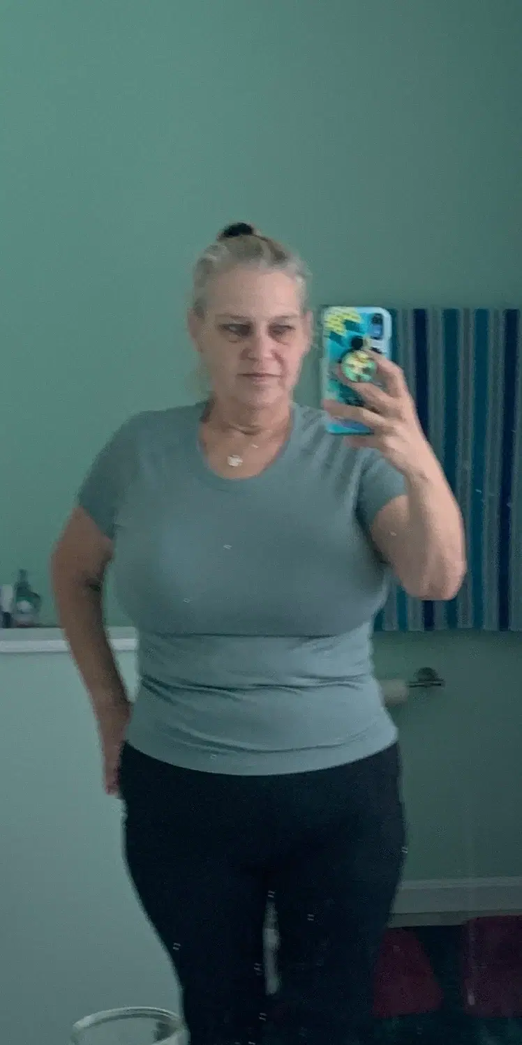 Victoria W. before treatment